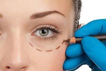 rhinoplastie marseille