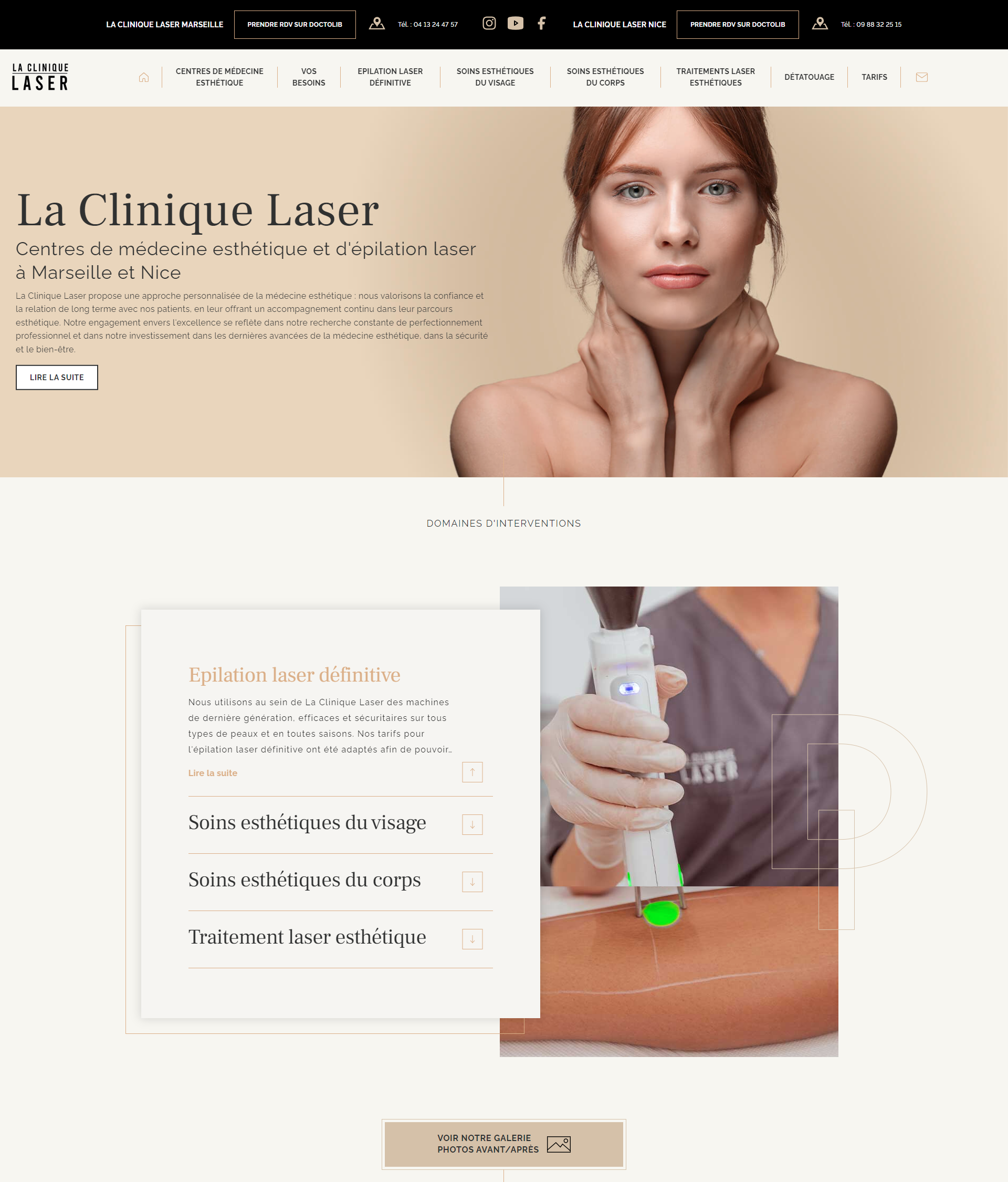 Le avant / après de La Clinique Laser