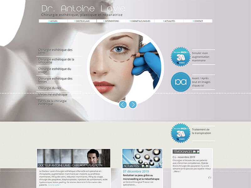 Avant / après du Docteur Lavie