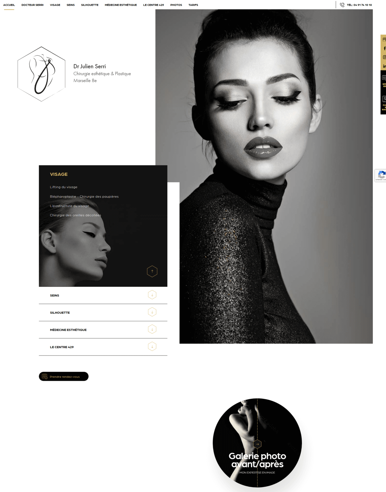 Avant / après du Docteur Serri