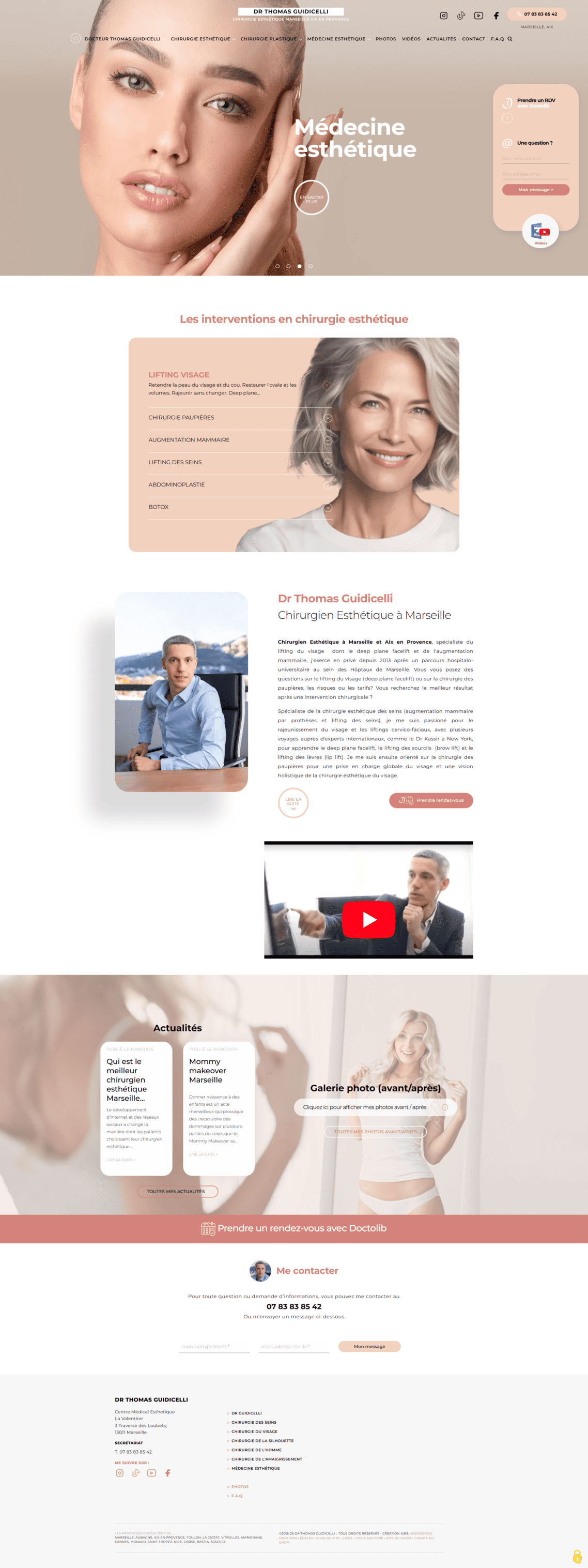 Avant / après du Docteur Guidicelli