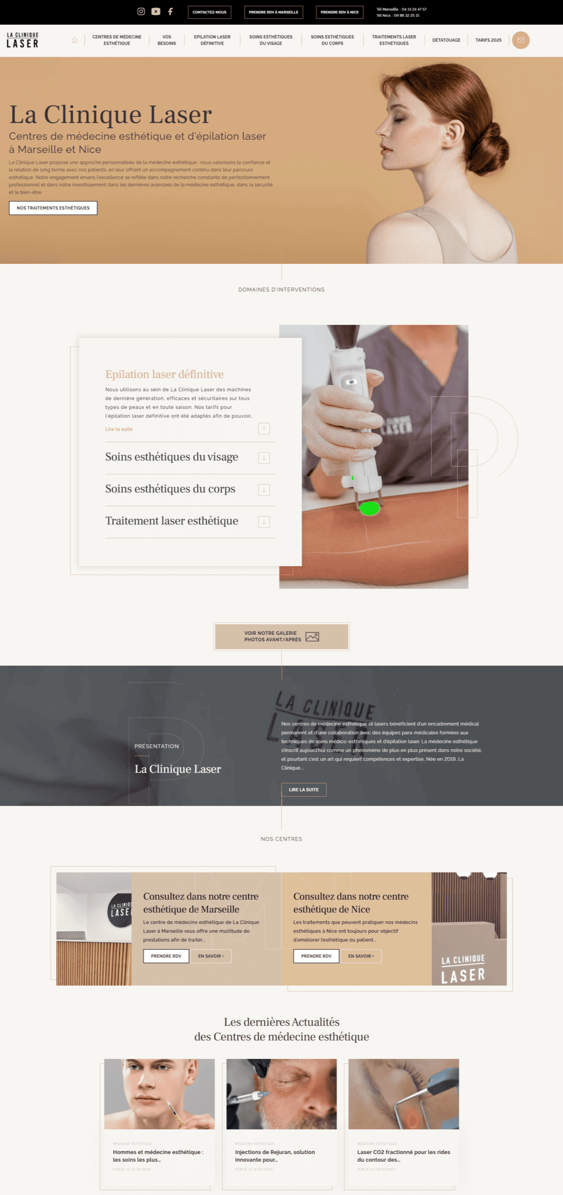 Avant / après de La Clinique Laser