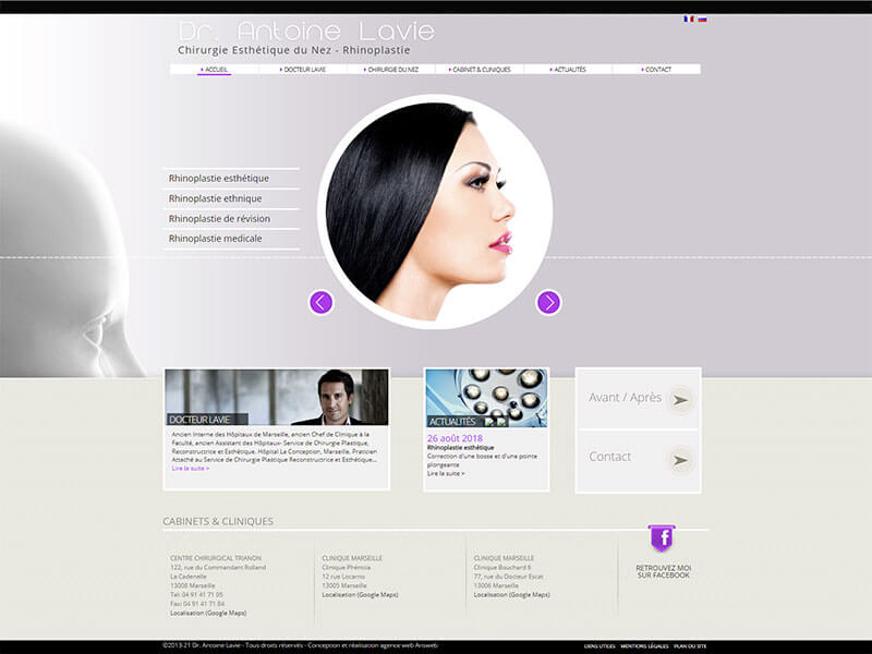 Avant / après du Docteur Lavie (rhinoplastie)