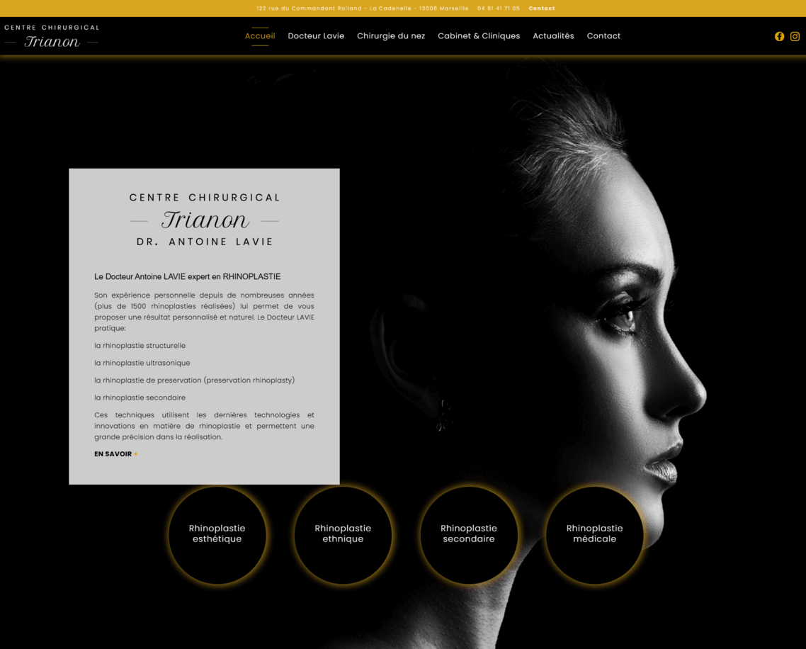 Avant / après du Docteur Lavie (rhinoplastie)