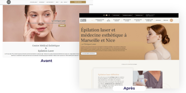 Le avant / après de La Clinique Laser