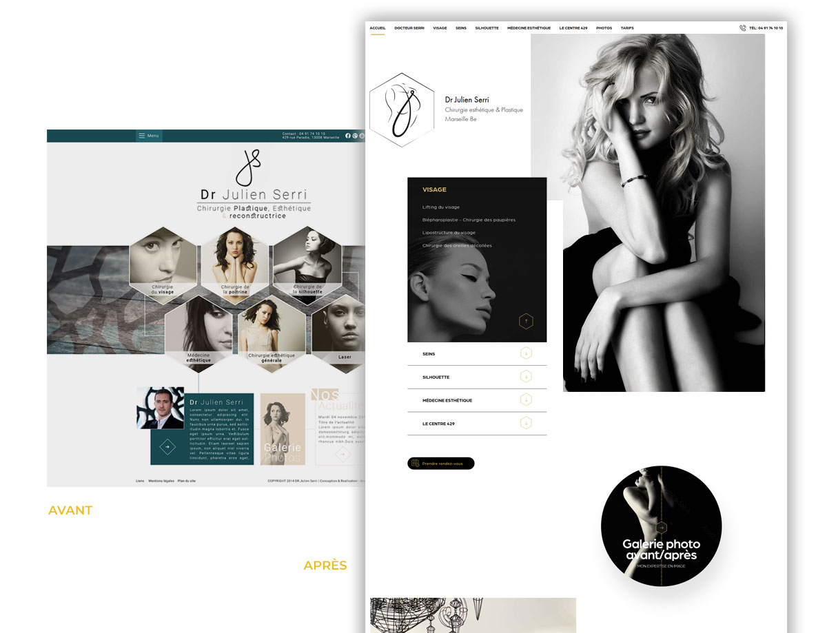 refonte-site-medecin-esthetique-avant-apres.jpg